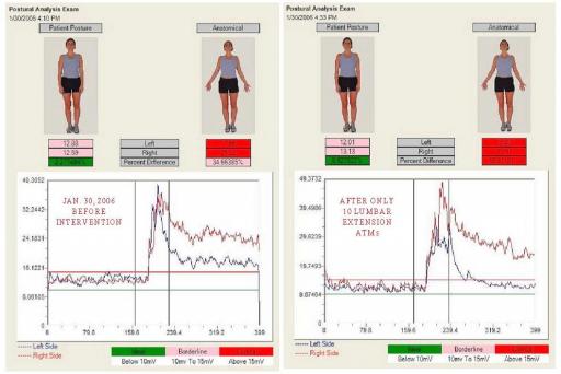 ATM2 Posture Case Study Session 2